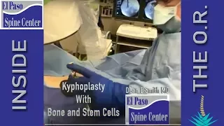 epspinecenter - Kyphoplasty with Bone and Stem Cells