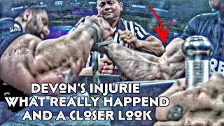 Devon's injurie what Really got injured and a closer look! king of the table 4