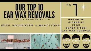 TOP 10 EAR WAX REMOVAL VIDEOS - NUMBER 1