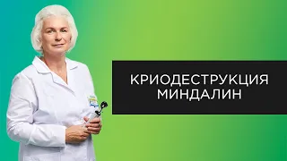 Криодеструкция миндалин