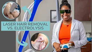 Laser Hair Removal vs Electrolysis for Hirsutism Facial Hair | PCOS , Black Skin Care