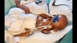 Schwangere (19) von Krankenhaus fies abgewiesen: Frühchen stirbt kurz darauf