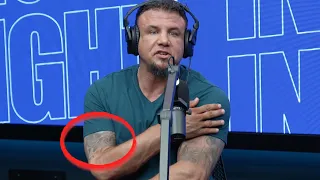 What Happened To Frank Mir’s Right Arm?