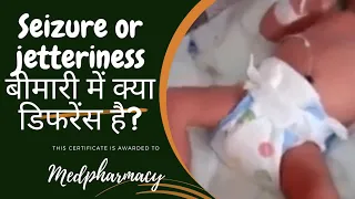 jetteriness in babies... / What is the difference between jetteriness and seizure in babies.. #viral