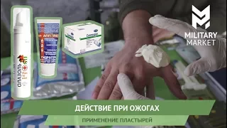 Действия при ожогах. Применение пластырей.