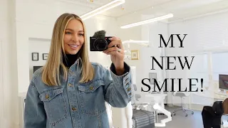 WEEKLY VLOG: MY NEW TEETH, COMPETING & VALENTINES PREP