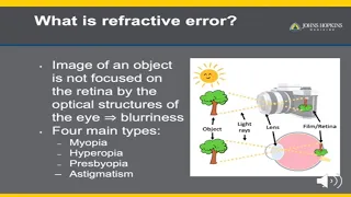 Refractive Error - A Patient Guide to Glasses