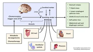 An Approach to Acute Nausea and Vomiting