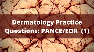 Dermatology Practice Questions | High Yield PANCE/EOR Prep (1)