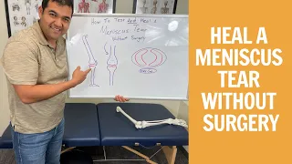 How To Test & Heal A Meniscus Tear Without Surgery
