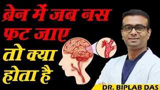 देखें, ब्रेन में जब नस फट जाए तो क्या होता है..? // Brain Hemorrhage // Dr. Biplab Das