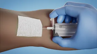 EasyPoint® Blood Collection Tube Holder with Needle