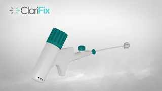 ClariFix   Patient Animation video