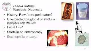 Helminths T solium