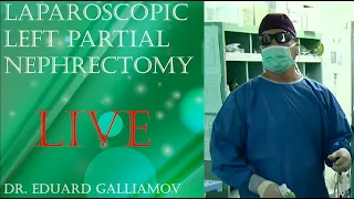 Laparoscopic Left partial nephrectomy LIVE / Лапароскопическая резекция почки