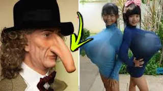 10 Most Unusual Longest Body Parts In The World