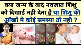 क्या जन्म के बाद शिशु को दिखाई नहीं देता या शिशु की आंखो मे कोई समस्या तो नहीं ? Newborn eye vision.