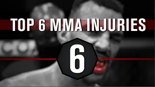 Bisping lists WORST MMA INJURIES in HISTORY!