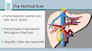 liver sonography