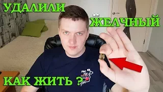 Мне УДАЛИЛИ ЖЕЛЧНЫЙ ПУЗЫРЬ! КАК дальше ЖИТЬ? Желчекаменная болезнь (ЖКБ) холелитиаз #3