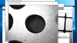 Using ImageJ to measure size