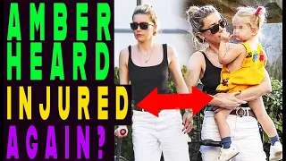 Amber Heard really injured or PR stunt?