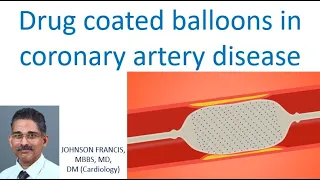 Drug coated balloons in coronary artery disease