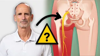 ISCHIAS Schmerzen: 3 wichtige Übungen für JEDEN TAG