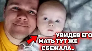 Увидев этого малыша - жена сразу сбежала из семьи! Отец в одиночку воспитывает «солнечного» ребенка!