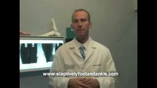 Dr. Timothy Holmes discusses ankle replacement candidates.