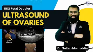 Ultrasound of OVARIES - Practical Scanning Technique by Dr. Sultan Moinuddin | Iqramed Academy