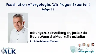 Rötungen, Schwellungen, juckende Haut: Wenn die Mastzelle eskaliert (Faszination Allergologie)