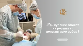 Как курение влияет на результат имплантации зубов?