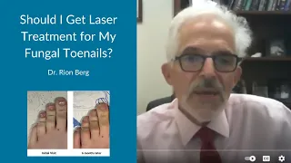 Should I Get Laser Treatment for My Fungal Toenails?