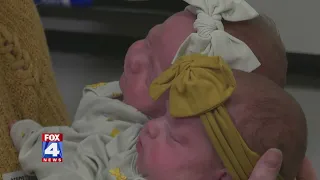 Rare 'MoMo' twins born at Overland Park Regional Medical Center