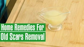 HOW TO REMOVE OLD SCARS FROM LEGS & FACE -  Natural Scar Removal