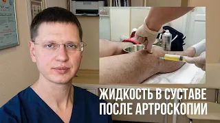 Почему собирается жидкость в коленном суставе после артроскопии?