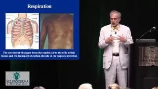 2016 New Orleans - Grand Lecture - "Scleroderma Lung Disease:  Why Am I So Short of Breath?"