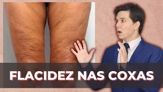 FLACIDEZ DAS COXAS: Acabe com a Flacidez do Corpo