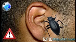 Top 10 Horrifying Things Ever found Inside a Human Ears