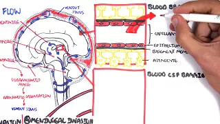 (Bacterial) Meningitis Pathophysiology