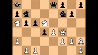 Garry Kasparov vs Veselin Topalov (Immortal Game Hoogovens 1999)