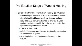 Chapter 38 Providing Wound Care and Treating Pressure Ulcers
