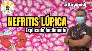 REUMATOLOGÍA | NEFRITIS LÚPICA