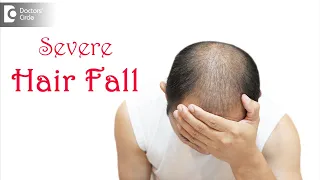 Severe Hair Fall or TELOGEN EFFLUVIUM | Sudden Hair Loss - Dr. Deepak P Devakar | Doctors' Circle