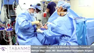 Orbital Tumor Lesion Surgery | (877) 697–5173