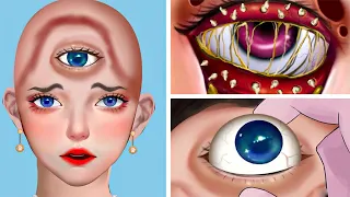 Synthetic ASMR Remove Parasitic & Maggots, Pustules in the eyes | Acne Deep Cleaning Animation