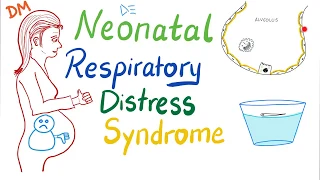 Neonatal Respiratory Distress Syndrome (NRDS)