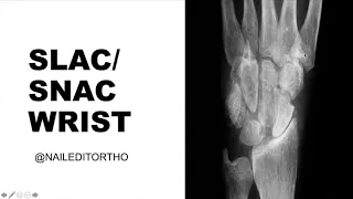 SLAC/SNAC Wrist w/ Dr. Rose