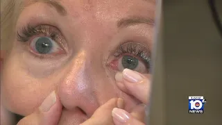 Contact lenses can provide allergy relief